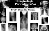 Aula 9 - Imaginologia Por Radiografias - Coluna Vertebral. Profº Claudio Souza