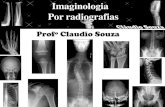 Aula 7 - Imaginologia Por Radiografias - Abdome. Prof. Claudio Souza - ATUALIZADA EM 05/2012