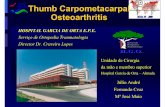 Thumb Carpo-Metacarpal Osteoarthritis. Júlio André, Fernando Cruz, MªJoséMaio