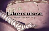Tuberculose - 12ºano Biologia