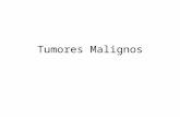 Tumores Malignos