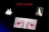 Albinismo 2