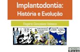 Implantodontia - História e Evolução