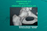 SÍNDROME DO IMPACTO FÊMORO ACETABULAR Andressa Zaccaro Canavezzi R3 Reumatologia - ISCMSP.