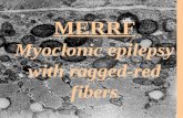 MERRF Myoclonic epilepsy with ragged-red fibers. FUNDAÇÃO FACULDADE FEDERAL DE CIÊNCIAS MÉDICAS DE PORTO ALEGRE DEPARTAMENTO DE CIÊNCIAS MORFOLÓGICAS.