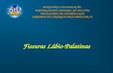 Fissuras Lábio-Palatinas MINISTÉRIO DA EDUCAÇÃO UNIVERSIDADE FEDERAL DE PELOTAS FACULDADE DE ODONTOLOGIA UNIDADE DE CIRURGIA BUCO-MAXILAR III.