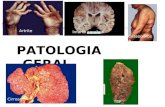 PATOLOGIA GERAL Osteoporose Artrite TEP Cirrose Infarto cerebral.