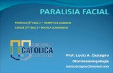 Prof. Lucio A. Castagno Otorrinolaringologia luciocastagno@hotmail.com Periférica (2º neur.) = HEMIFACE ipsilateral Central (1º neur.) = MAXILA contralateral.