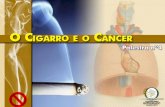 Este pulmão pertenceu ao cidadão que fumou durante 25 anos e morou na cidade de São Paulo.