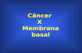 Câncer X Membrana basal. Câncer = proliferação descontrolada de células.