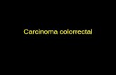 Carcinoma colorrectal. Epidemiologia Incidência e Mortalidade por Países Carcinoma colorrectal esporádico.