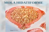MOLA HIDATIFORME. Evolução Normal da Gestação Divisão Celular Fecundação Ciclo Menstrual.