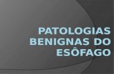 Patologias Benignas do Esôfago Dra. Julia Pedroni de Carvalho Médica Residente (R1) – Cirurgia Geral Hospital Federal Cardoso Fontes Orientador: Dr. Antônio.