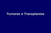 Tumores e Transplantes. Histologia Tumoral Celula Tumoral- teoria da imunovigilância-Celula Tumoral- aquela na qual há um desiquilíbrio na proliferação.