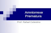 Amniorrexe Prematura Prof. Rafael Celestino. Aminiorrexe prematura (RPMO) Também definida como rotura prematura das membranas, complica cerca de 10% dos.