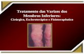 Tratamento das Varizes dos Membros Inferiores: Cirúrgico, Escleroterápico e Fisioterapêutico.
