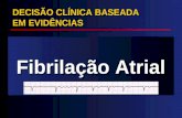 DECISÃO CLÍNICA BASEADA EM EVIDÊNCIAS Fibrilação Atrial.