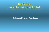 Nefrite tubulointersticial Edevanilson Gueiros Definição É a perda súbita da função renal ( início em horas ou dias) com repercussão em todo os orgãos.