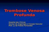 Trombose Venosa Profunda Hospital das Clínicas Serviço de Angiologia e Cirurgia Vascular Prof. Ly de Freitas Fernandes.