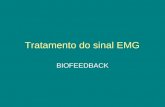 Tratamento do sinal EMG BIOFEEDBACK. Resumo Desenvolver um circuito amplificador para aquisição de sinais da atividade elétrica muscular. Estes sinais.