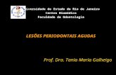 Universidade do Estado do Rio de Janeiro Centro Biomédico Faculdade de Odontologia LESÕES PERIODONTAIS AGUDAS Prof. Dra. Tania Maria Galheigo.