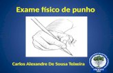 Exame físico de punho Carlos Alexandre De Sousa Teixeira.