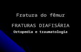 Fratura do fêmur FRATURAS DIAFISÁRIA Ortopedia e traumatologia.