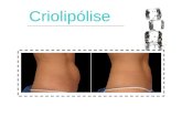 Criolipólise. Definição  Tratamento estético, não-invasivo, que utiliza a técnica de congelamento para redução de medidas e eliminação da gordura localizada.