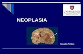 NEOPLASIA Renatta Pontes. Neoplasia  Doença crônica,  Evolução relativamente lenta,  É hoje a mais curável de todas as doenças crônicas, quando detectado.