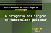 A patogenia das imagens na tuberculose pulmonar A patogenia das imagens na tuberculose pulmonar Fiuza de Melo Fiuza de Melo Curso Nacional de Atualização.