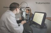 Tratamento Fotocoagulação a laser. Selamento do extravasamento vascular Formação de necroses e cicatrizes Elevação da temperatura da coroide e da retina.