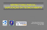NEFRECTOMIA PARCIAL: DUPLICAÇÃO DA TÉCNICA ABERTA Prof. Gilvan Neiva Fonseca Chefe do Serviço de Urologia HC / FM / UFG.