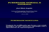 21 Puberdade Masculina Normal Anormal