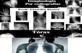 Aula 8 - Imaginologia Por Radiografias - Tórax. Profº Claudio Souza