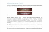 Clareamento dental caseiro - Artigo