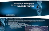 Anemia Aplastica