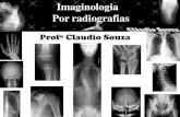 Aula 5 Imaginologia por radiografias- Tornozelo, calcaneo, pé e antepe- ProfºClaudio Souza