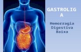 GASTROLIGA - Hemorragia Digestiva Baixa (HDB)