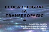 Ecocardiografia Transesofagica