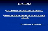 Tiroides en ecografia. Dr. Alessandri Roberto