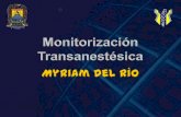 Monitorización transanestésica