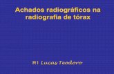 Achados radiográficos na radiografia de tórax