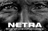 Netra, a câmera oftalmológica