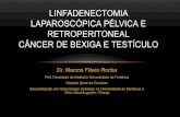 Linfadenectomia laparoscópica pélvica e retroperitoneal