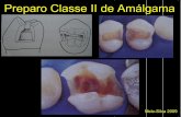 Preparo classe ii amálgama   2011-2