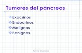 35 Tumores Pancreas