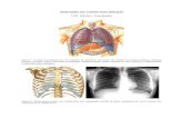 Anatomia do tórax