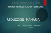 Reduccion mamaria CARLOS MATOS