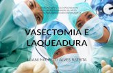 Vasectomia e Laqueadura