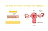 Trompa uterina - ANATO.pptx